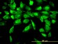 ACY1 Antibody (monoclonal) (M01)
